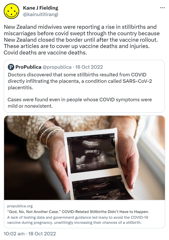New Zealand midwives were reporting a rise in stillbirths and miscarriages before covid swept through the country because New Zealand closed the border until after the vaccine rollout. These articles are to cover up vaccine deaths and injuries. Covid deaths are vaccine deaths. Quote Tweet. ProPublica @propublica. Doctors discovered that some stillbirths resulted from COVID directly infiltrating the placenta, a condition called SARS-CoV-2 placentitis. Cases were found even in people whose COVID symptoms were mild or nonexistent. Propublica.org. God No Not Another Case. COVID-Related Stillbirths Didn’t Have to Happen. A lack of testing data and government guidance led many to avoid the COVID-19 vaccine during pregnancy, unwittingly increasing their chances of a stillbirth. 10:02 am · 18 Oct 2022.